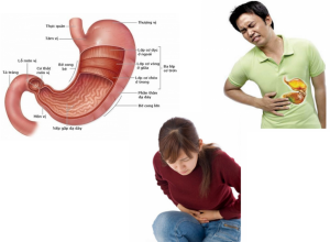Những bài thuốc chữa dạ dày hiệu quả nhất mà bạn cần phải biết
